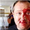 В красноярском избиркоме кандидат в депутаты Заксобрания избил своего конкурента